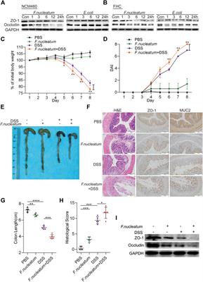 Corrigendum: Fusobacterium nucleatum Activates Endoplasmic Reticulum Stress to Promote Crohn’s Disease Development via the Upregulation of CARD3 Expression